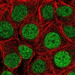 SLMO2 Antibody, Novus Biologicals 0.1mL; Unlabeled:Antibodies, Polyclonal